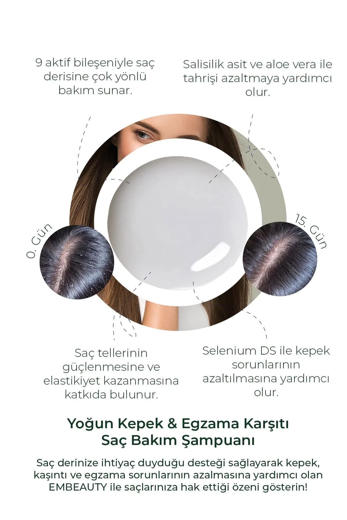 Kepek Kaşıntı Ve Egzama Karşıtı 9 Aktifli Kepek Karşıtı Tuzsuz Sampuan 400 ml