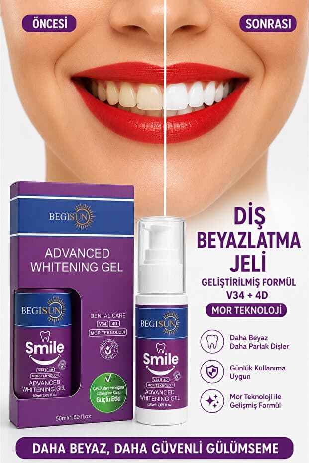 Begisun V34 + 4D | Mor Teknoloji ile Gelişmiş Formül Diş Beyazlatma Jeli